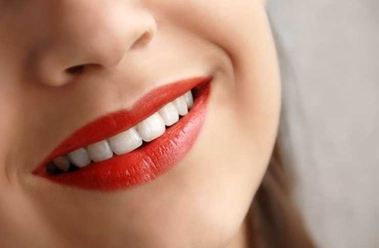 Ini Penyebab Tumbuh Kumis Wanita