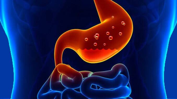 Sakit Maag Kambuh? Ramuan Cinta Solusinya