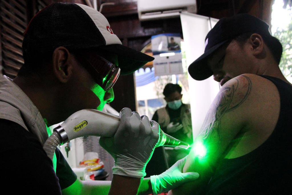 DPP Fuhab Gelar Hapus Tato Gratis
