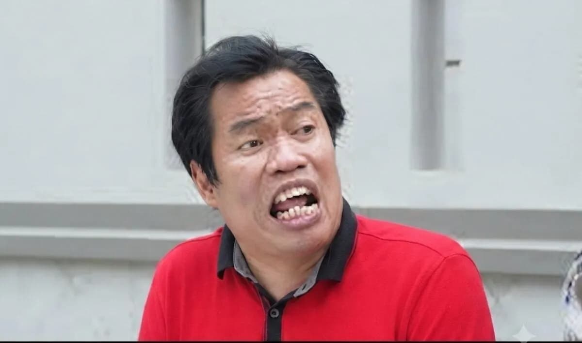 Temon Meninggal akibat Serangan Jantung, Riwayat Hipertensi Jadi Sorotan