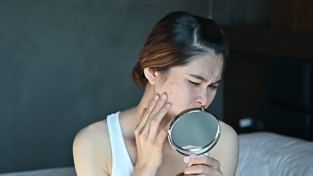 Tips Atasi Wajah Bruntusan Secara Alami