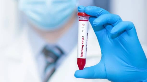 Tewaskan 5 orang di Tanzania, Apa Itu Virus Marburg?