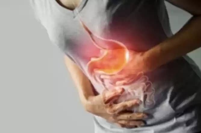 Foto Ilustrasi Sakit kangker Lambung