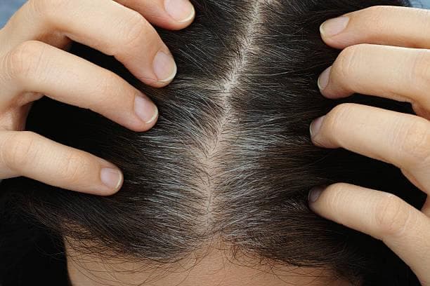 ​7 Kebiasaan yang Bikin Uban Tumbuh Lebih Cepat