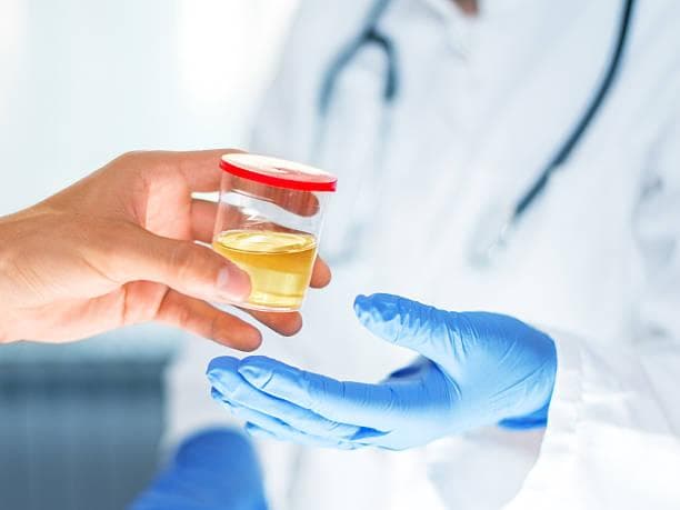 Dites Urine, Pesulap Oge Arthemus Positif Ganja