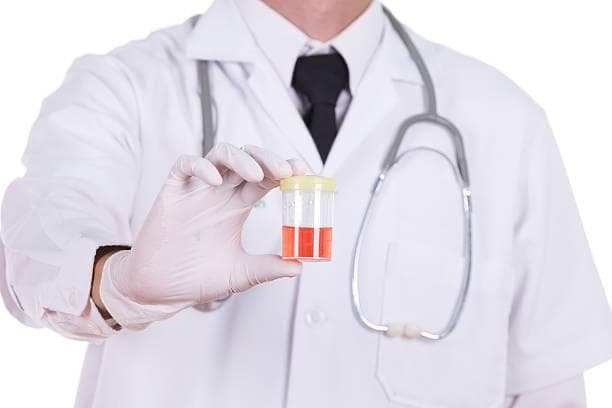 Urine Berbau Tak Sedap, Waspadai Penyakit Berikut!