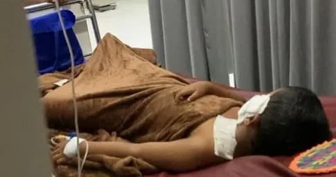 Balon Gas Meledak di Perayaan Hari Koperasi Klungkung, 11 Orang Terluka, Mayoritas Anak-anak