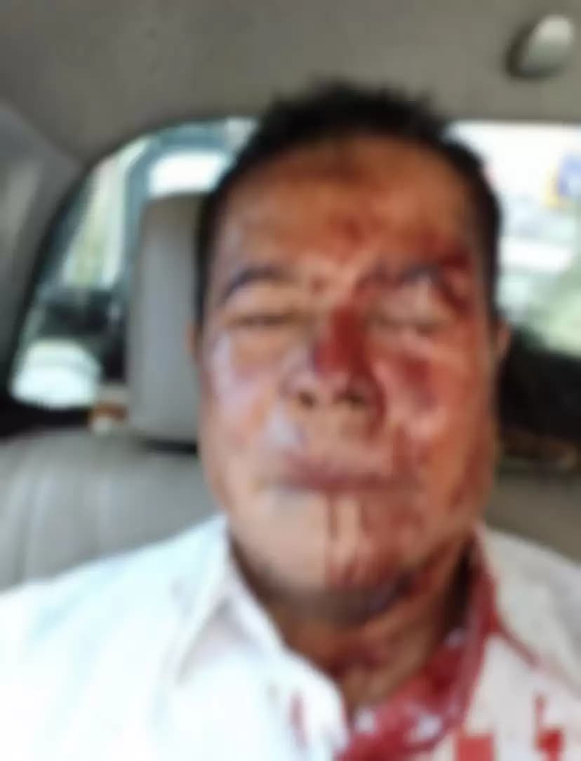 Penjabat Gubernur Papua, Ridwan Rumasukun yang ikut arak-arakan menjadi korban (Foto: Istimewa)