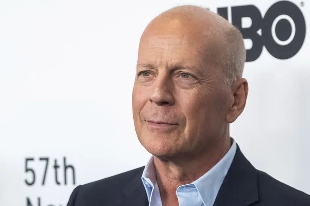 Bruce Willis Didiagnosis Demensia Frontotemporal, Apa itu?