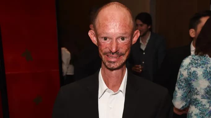 Bintang Game of Thrones Darren Kent Meninggal Dunia di Usia 36 Tahun