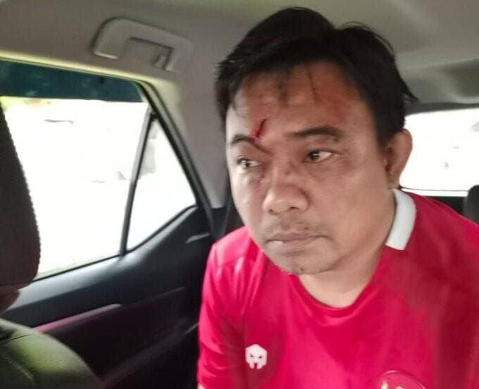 Politisi Golkar Tersangka Kasus Penyerangan Ketum KNPI, Terancam 9 Tahun Penjara