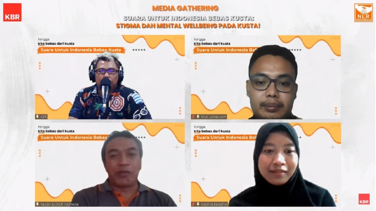 Informasi yang Benar Mampu Kikis Stigma Kusta
