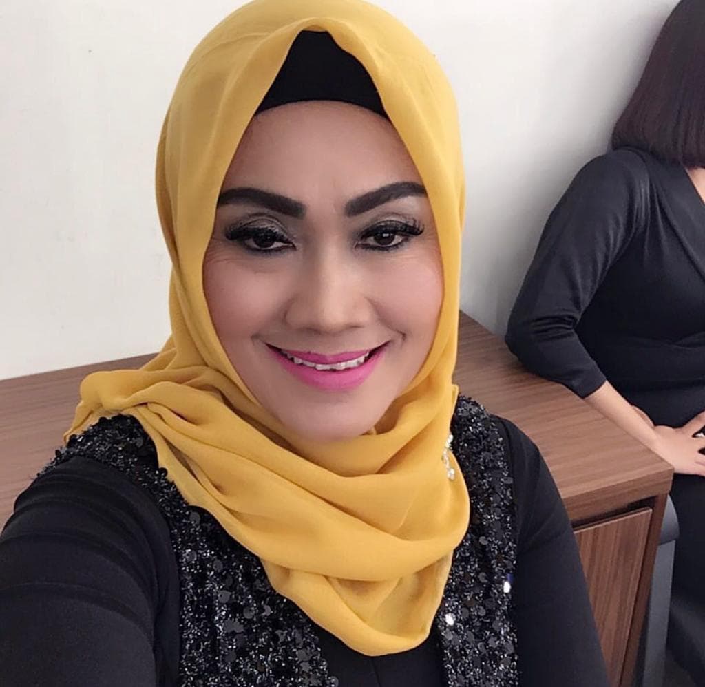 Ibunda Julia Perez Jadi Korban Kecelakaan, Terpental hingga Alami Gegar Otak