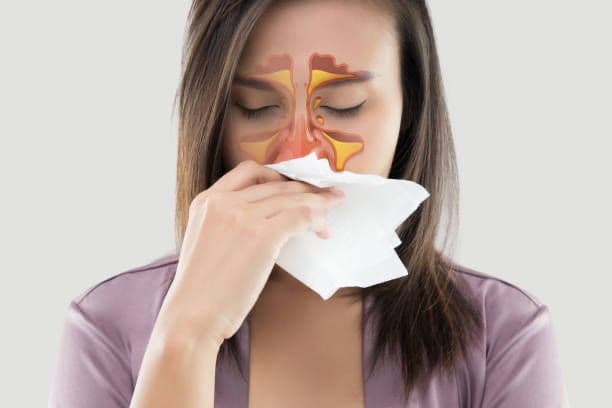 Intip Cara Alami Redakan Sinusitis di Rumah