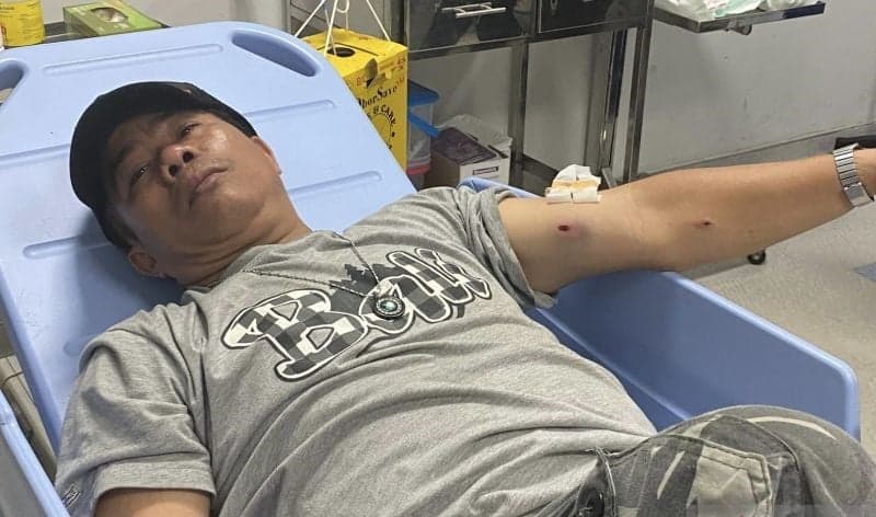Ketua RT Semper Barat Tertembak Pencuri Motor
