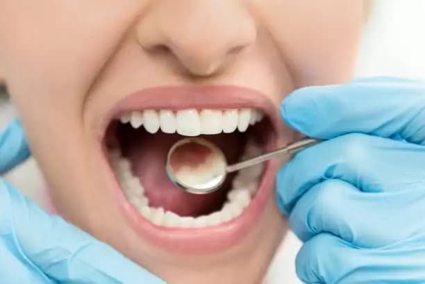 Benarkah Gigi Goyang Bisa Jadi Tanda Diabetes?