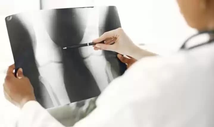 Foto Dokter melihat foto rontgen tulang pasien