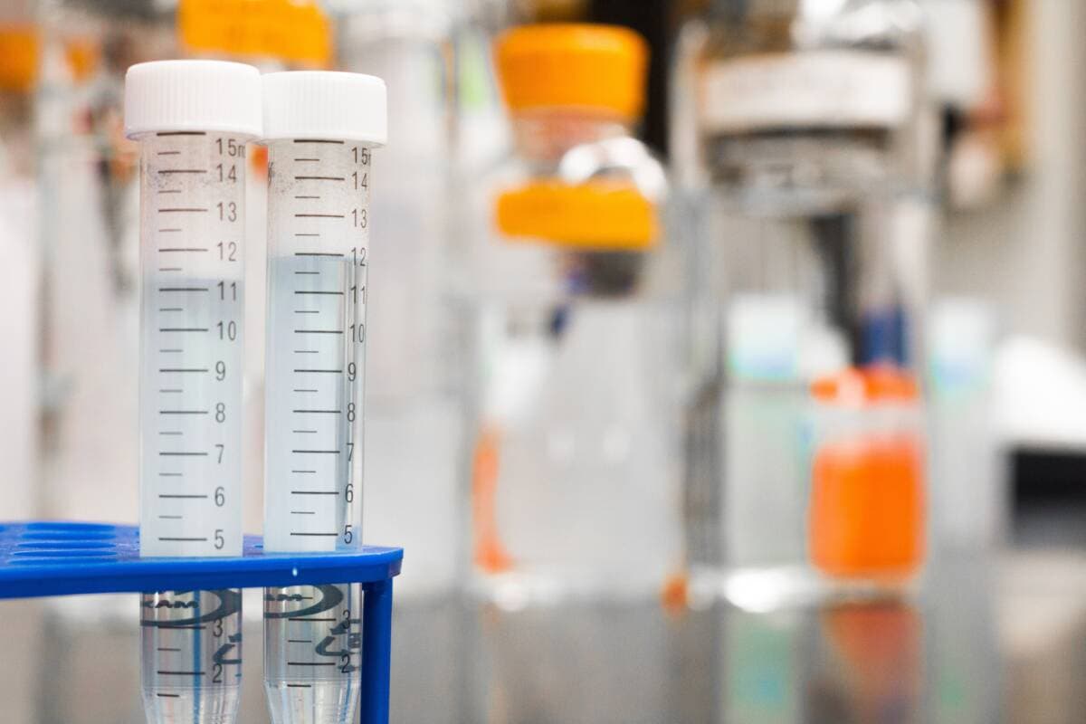 Pasien Ebola Ketiga Meninggal di Republik Demokratik Kongo