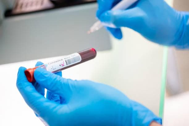 Apa Itu Disease X, Pandemi Selanjutnya yang Disebut Lebih Mematikan dari Covid-19?