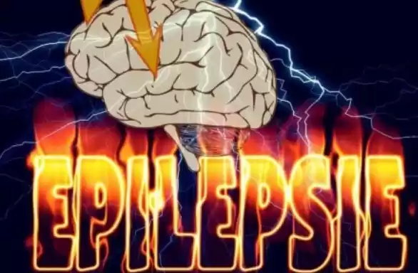Ilustrasi-Epilepsi. (Foto: Antara)