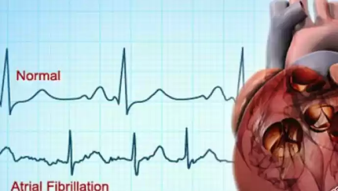 Skrining Dilakukan untuk Deteksi Risiko Kelainan Jantung
