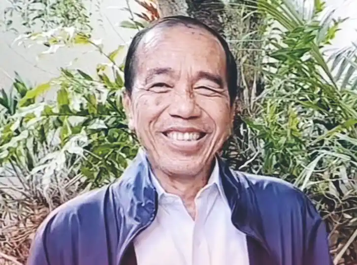 Jokowi diduga alami Sindrom Stevens Johnson (Foto: Ist)