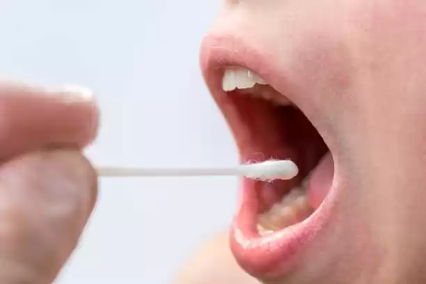 Tips Menjaga Kesehatan Mulut